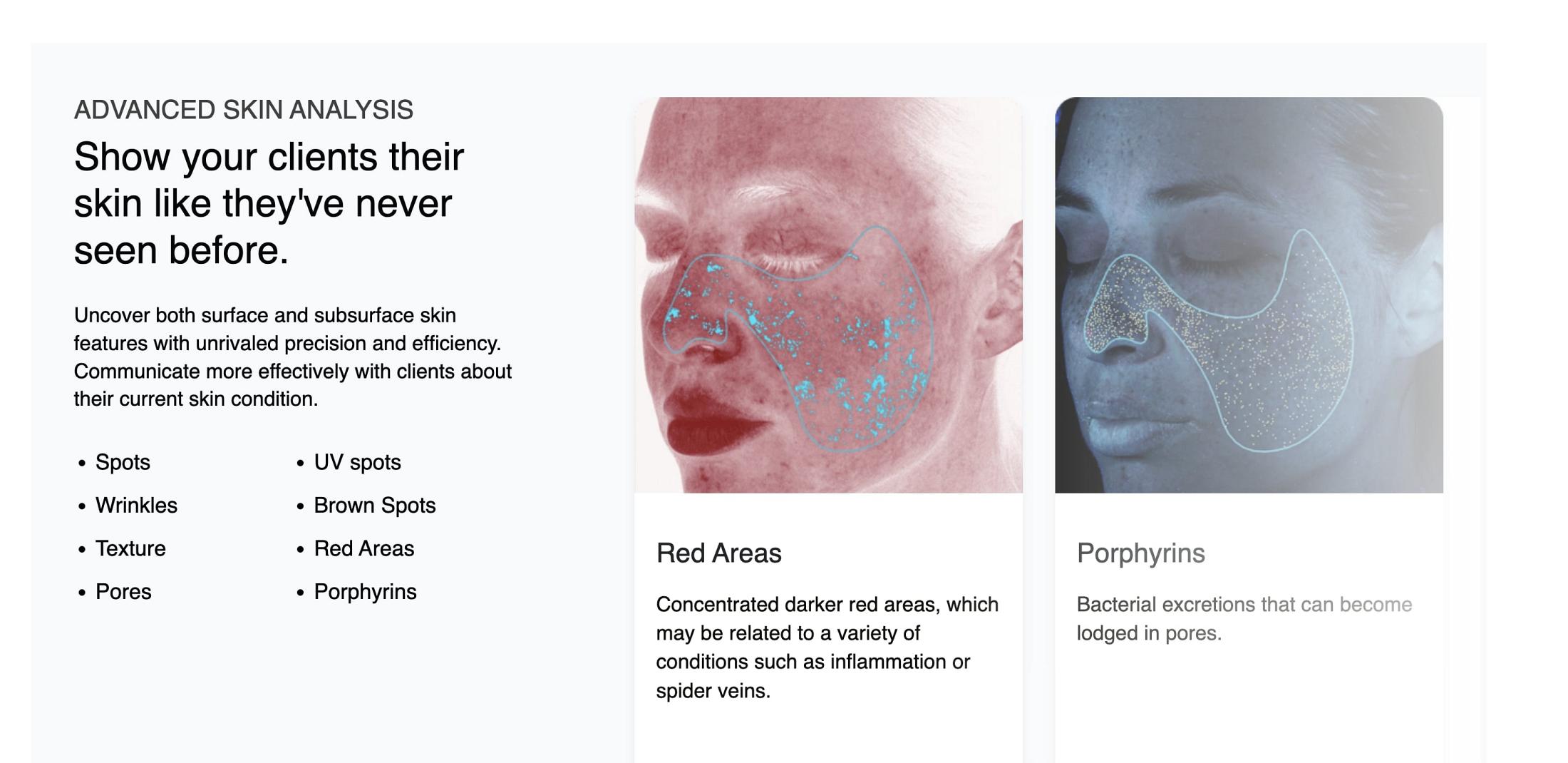 visia infographic