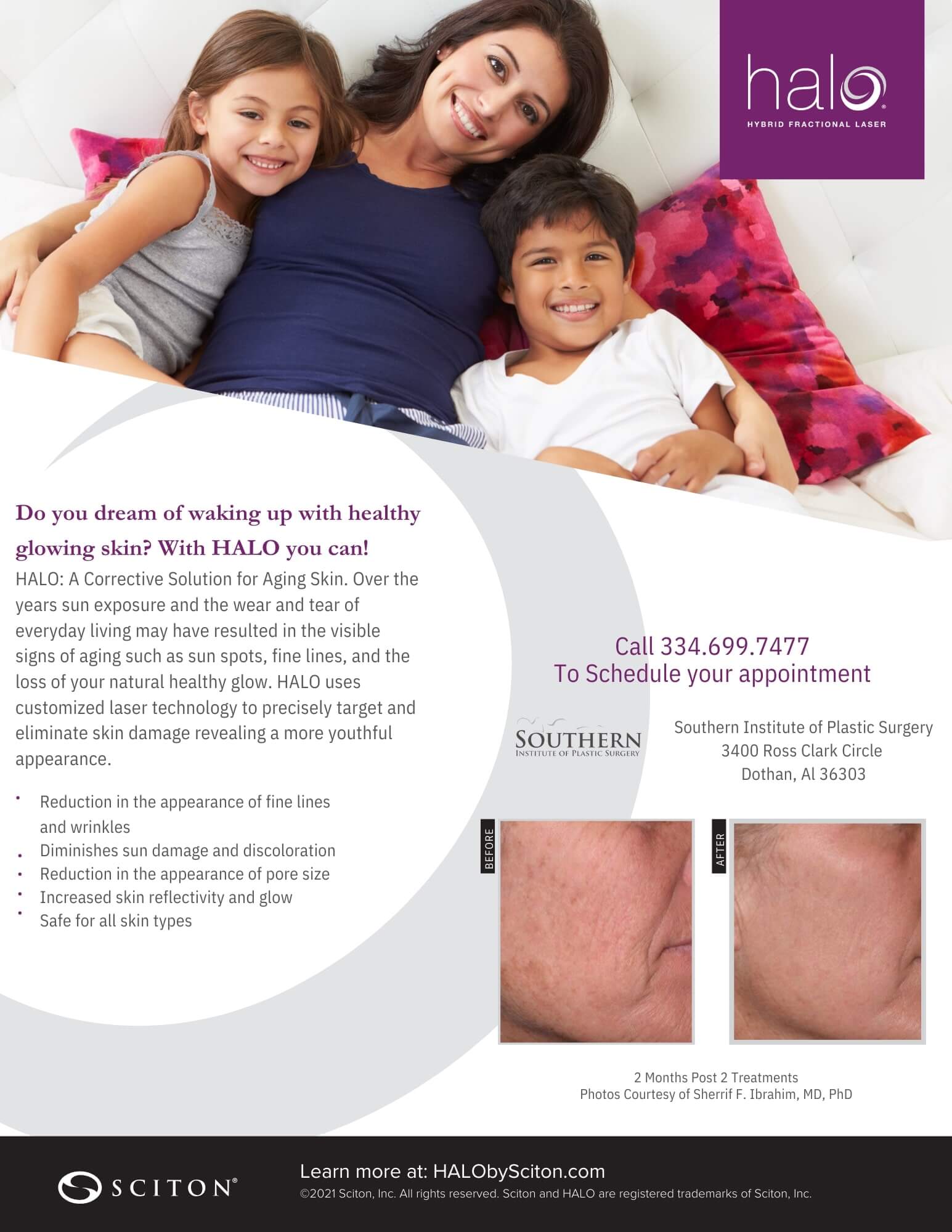 HALO Laser Skin Resurfacing pamphlet